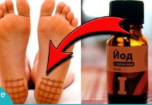 აი, რისთვის არის სასარგებლო ფეხის ქუსლებზე იოდის ბადე და როგორ უნდა დაიხატოთ ის. საინტერესოა…