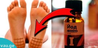 აი, რისთვის არის სასარგებლო ფეხის ქუსლებზე იოდის ბადე და როგორ უნდა დაიხატოთ ის. საინტერესოა…
