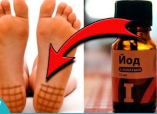 აი, რისთვის არის სასარგებლო ფეხის ქუსლებზე იოდის ბადე და როგორ უნდა დაიხატოთ ის. საინტერესოა…