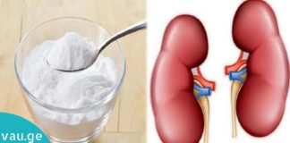 აი, რა მოუვა თქვენს თირკმელებს თუ ნახევარ კოვზ საკვებ სოდას მიიღებთ…