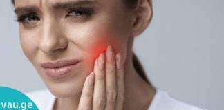 აი, რატომ უნდა დაიდოთ ეს საშუალება კბილებზე-მომენტალური შედეგი სახლის პირობებშივე!