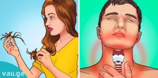 როგორ მოვამარაგოთ ორგანიზმი იოდის საჭირო დოზით. სასარგებლო ინფორმაციაა