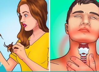 როგორ მოვამარაგოთ ორგანიზმი იოდის საჭირო დოზით. სასარგებლო ინფორმაციაა