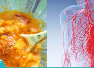 ეს მიქსტურა გაგიწმენდთ სისხლძარღვებს და დაგირეგულირებთ არტერიულ წნევას.