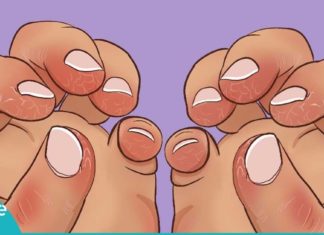 ხერხი, რომელიც გაუხეშებულ ხელებსა და ფრჩხილებზე იდეალურად მოქმედებს