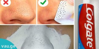 წყალი, სოდა და კბილის პასტა, ამ ნაზავით ეს გოგო დაემშვიდობა შავ ფერისმჭამელებს.