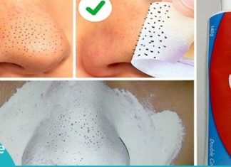 წყალი, სოდა და კბილის პასტა, ამ ნაზავით ეს გოგო დაემშვიდობა შავ ფერისმჭამელებს.