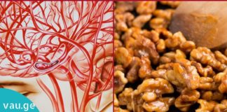 5 ყველაზე ეფექტური მეთოდი თავის ტვინის სისხლძარღვების გასაწმენდად. ის, რაც ყველას სჭირდება