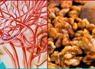 5 ყველაზე ეფექტური მეთოდი თავის ტვინის სისხლძარღვების გასაწმენდად. ის, რაც ყველას სჭირდება