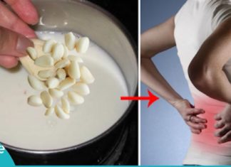 რძე და ნიორი-საუკეთესო კომბინაცია რადიკულიტის წინააღმდეგ. ეს აუცილებლად უნდა იცოდეთ