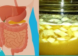 გერმანული რეცეპტი, რომელიც ამცირებს ქოლესტერინს, არეგულირებს წნევას და წმენდს სისხლძარღვებს