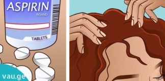 მან ასპირინისგან აი ეს ნიღაბი დაამზადა-იდეალური საშუალება თქვენი თმისთვის