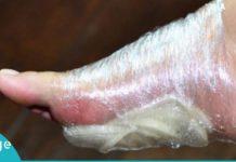 აი, რა მოხდება თუ ხახვს ფეხებზე დაიდებთ. საჭირო ინფორმაცია, რომელიც ბევრისთვის უცნობია