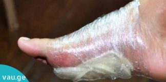 აი, რა მოხდება თუ ხახვს ფეხებზე დაიდებთ. საჭირო ინფორმაცია, რომელიც ბევრისთვის უცნობია