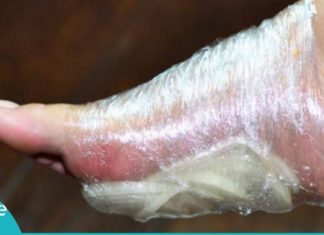 აი, რა მოხდება თუ ხახვს ფეხებზე დაიდებთ. საჭირო ინფორმაცია, რომელიც ბევრისთვის უცნობია