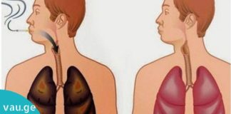 როგორ გავიწმინდოთ სიგარეტისგან დაბინძურებული ფილტვები 72 საათის განმავლობაში…