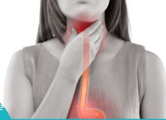 ამ 3 მეთოდით გულძმარვას სამუდამოდ დაემშვიდობებით!