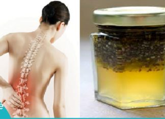 როგორ მოვიშოროთ ოსტეოპოროზი სამუდამოდ? ყველაზე ეფექტური და სანდო ხერხი