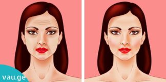 როგორ გავიკეთოთ ავტოლიფტინგი? საუკეთესო საშუალება სახის კანის მოსავლელად