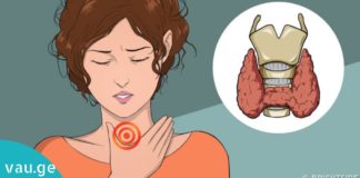 შეამოწმეთ საკუთარი თავი! ფარისებრი ჯირკვლის პრობლემის 12 სიმპტომი