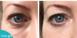 ეფექტური და სასარგებლო ნიღაბი ქუთუთოებისთვის. შეინარჩუნეთ კანის სილამაზე!