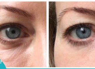 ეფექტური და სასარგებლო ნიღაბი ქუთუთოებისთვის. შეინარჩუნეთ კანის სილამაზე!