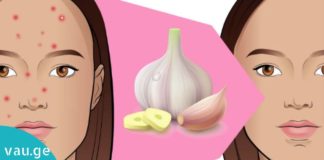 დაამარცხეთ გამონაყარი სახეზე ნიორის დახმარებით. ამაზე ეფექტური საშუალება არ არსებობს!