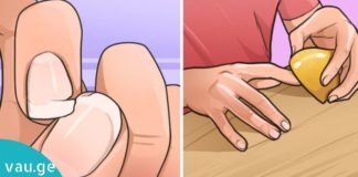 ყველაზე ეფექტური და მარტივი საშუალება მტრევადი ფრჩხილების წინააღმდეგ– საინტერესოა