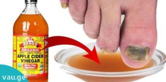 აი რისთვის იყენებს ის ვაშლის ძმარს. ასეთ შედეგს ნამდვილად არ ველოდი!