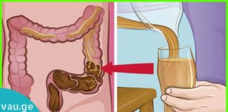 ნაწლავების გასასუფთავებელი ნატურალური საშუალება-ეს უნდა სცადოთ!