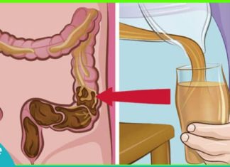 ნაწლავების გასასუფთავებელი ნატურალური საშუალება-ეს უნდა სცადოთ!