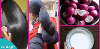 აი, ასე გაიზარდა თმა მან რამდენიმე კვირაში. სცადეთ ყველაზე ეფექტური ნიღბები