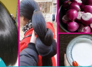 აი, ასე გაიზარდა თმა მან რამდენიმე კვირაში. სცადეთ ყველაზე ეფექტური ნიღბები