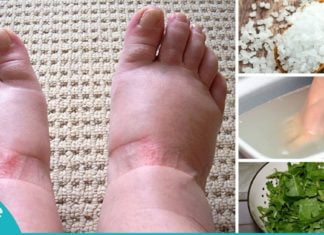 რა იწვევს ფეხების შეშუპებას და როგორ ვუშველოთ ამ პრობლემას?! ეს რჩევები დაგეხმარებათ