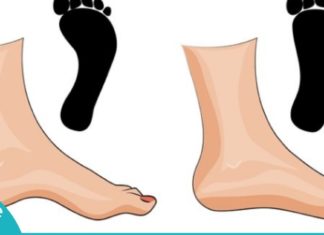 შეიძლება თუ არა ბრტყელტერფიანობამ სერიოზული დაავადებების გამოიწვიოს?! ამას არ მოველოდი