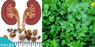 თირკმელების გაწმენდის ეფექტური საშუალება. მოამზადეთ სახლში მარტივად