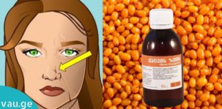 ქაცვის ზეთი ნაოჭების წინააღმდეგ! იაფი საშუალება გარანტირებული შედეგით!