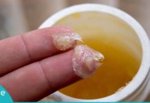 შეუფასებელი მალამო, რომელმაც არაერთი სიცოცხლე გადაარჩინა