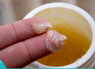 შეუფასებელი მალამო, რომელმაც არაერთი სიცოცხლე გადაარჩინა