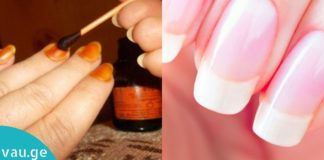 რატომ უნდა წავისვათ იოდი ფრჩხილებზე? მიიღეთ საოცარი შედეგი მარტივად!