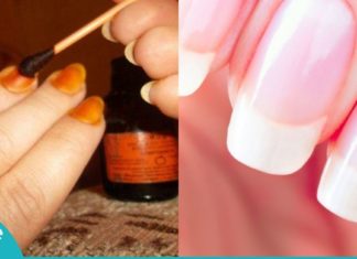 რატომ უნდა წავისვათ იოდი ფრჩხილებზე? მიიღეთ საოცარი შედეგი მარტივად!