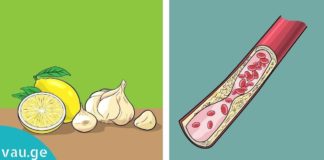 როგორ გავიწმინდოთ სისხლძარღვები სახლის პირობებში? რეცეპტები, რომლებიც იდეალურ შედეგს მოგცემთ