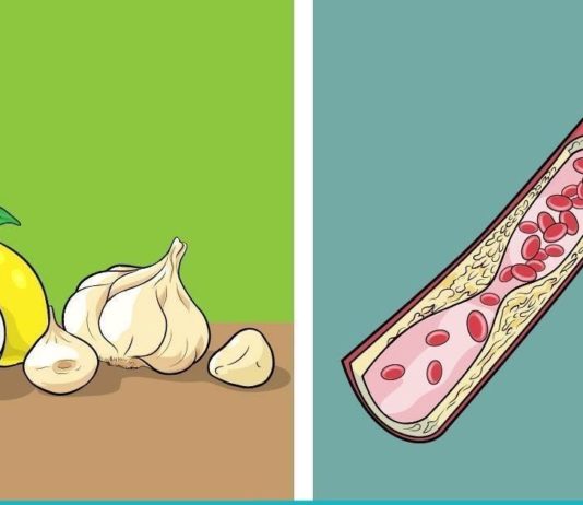 როგორ გავიწმინდოთ სისხლძარღვები სახლის პირობებში? რეცეპტები, რომლებიც იდეალურ შედეგს მოგცემთ