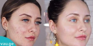 აი ასე უნდა მოვიშოროთ აკნესგან დატოვებული ნაიარევი ნატურალური პროდუქტების დახმარებით!