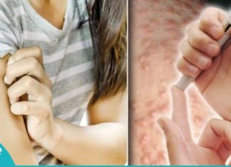 დიაბეტის ყველაზე გავრცელებული სიმპტომები. ის, რასაც ყურადღება ყველამ უნდა მიაქციოს