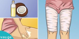 მან ფეხები შეიხვია და მთელი ღამით გაიჩერა. აი, რა მოხდა მეორე დღეს