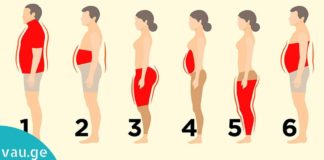 სიმსუქნის 6 ტიპი. რა იწვევს და როგორ ვებრძოლოთ ჭარბ წონას? ამის შემდეგ ფორმაში იქნებით