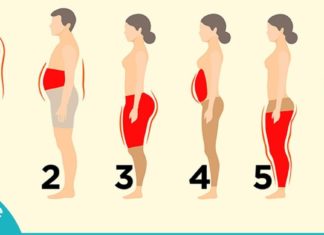 სიმსუქნის 6 ტიპი. რა იწვევს და როგორ ვებრძოლოთ ჭარბ წონას? ამის შემდეგ ფორმაში იქნებით