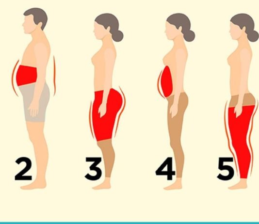 სიმსუქნის 6 ტიპი. რა იწვევს და როგორ ვებრძოლოთ ჭარბ წონას? ამის შემდეგ ფორმაში იქნებით