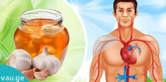 თაფლი, ნიორი და ლიმონი- ნაზავი, რომელიც თქვენს ორგანიზმს სჭირდება. გაიგეთ მეტი…